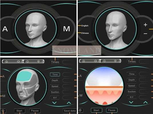 半導体808nmレーザーダイオードレーザー脱毛機、肌接触センサー付き、高速脱毛トリートメントを実現