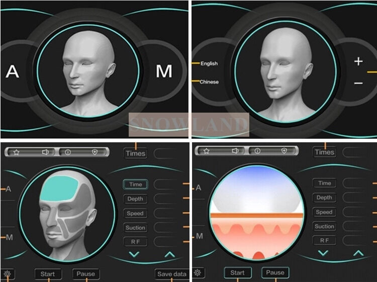 半導体808nmレーザーダイオードレーザー脱毛機、肌接触センサー付き、高速脱毛トリートメントを実現
